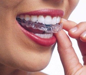 EssixRetainer